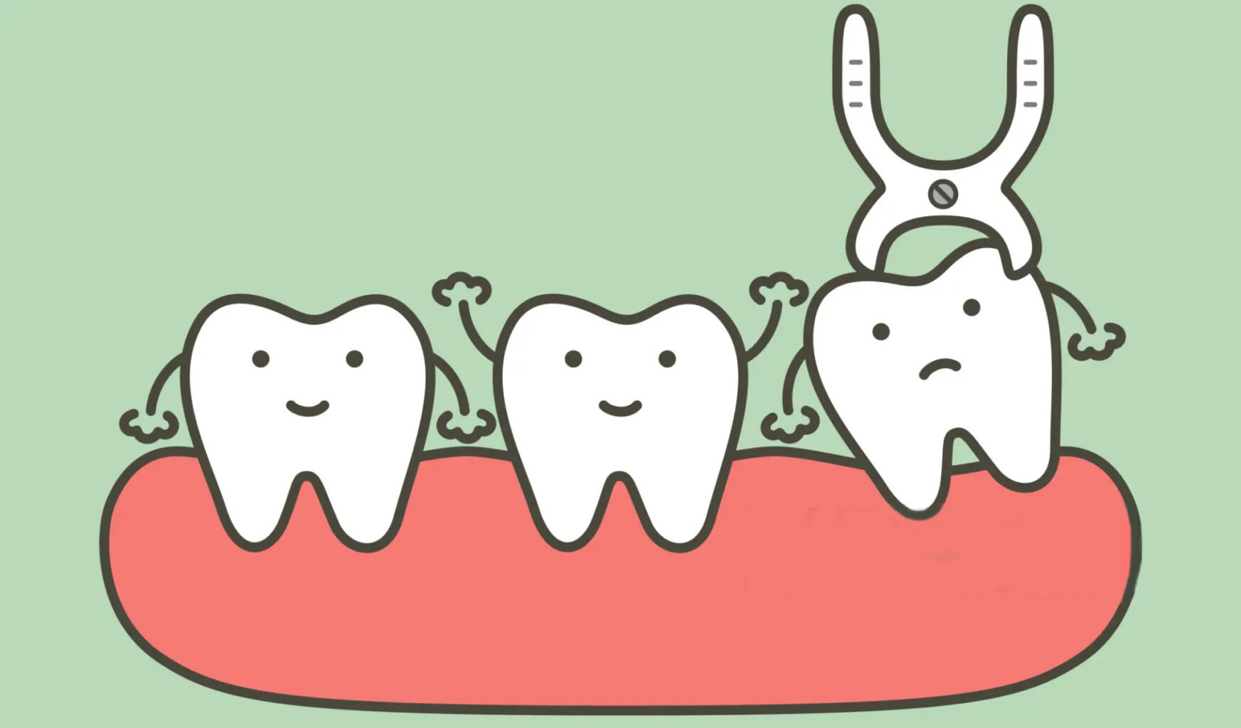 Tooth Extractions - Bondi Junction Dental | A Smile Lights Up Your Day ...